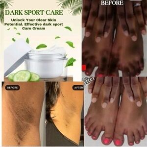 Dark Spot Remover 2oz